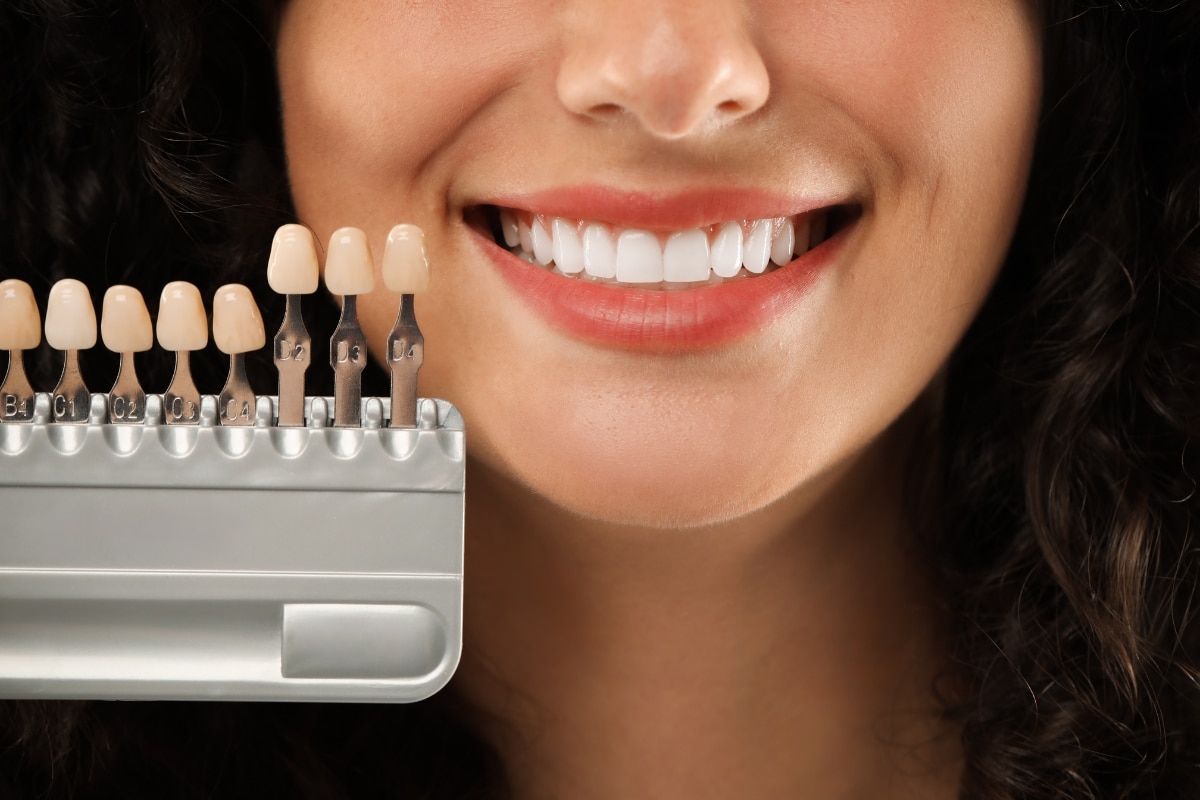 Keep Your Smile White with Teeth Whitening in Waukegan