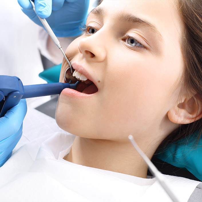 Sealants - Dental Services